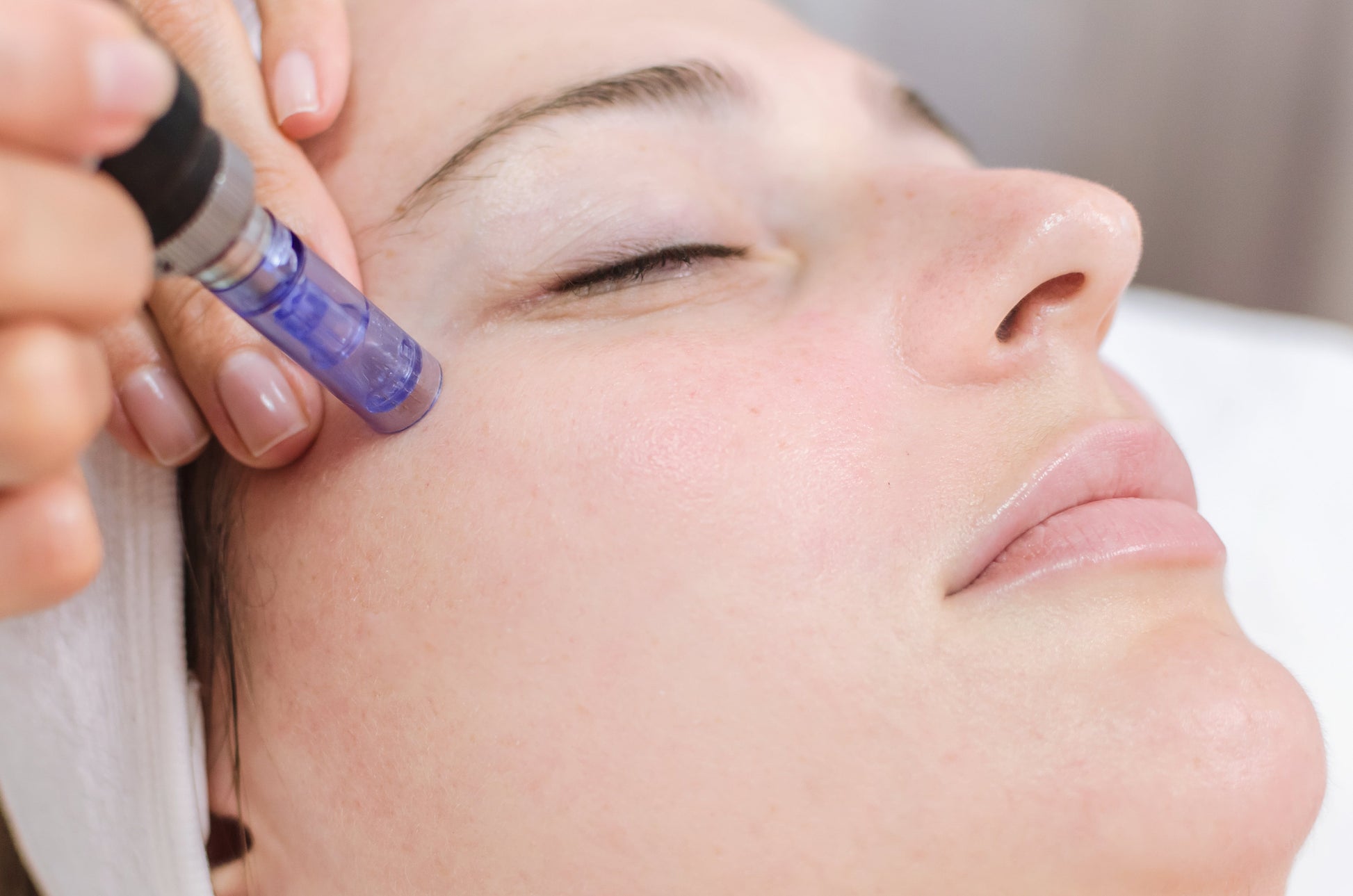 Bio Plasma Pen - Skin Care Device