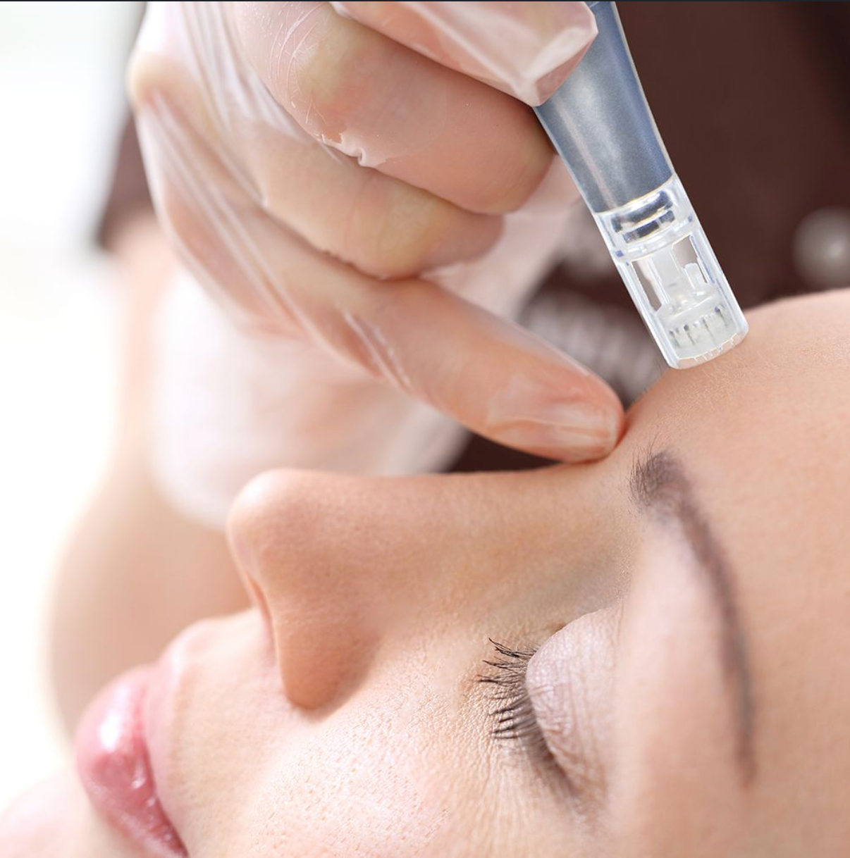Microneedling Bio Pen Kit - Microneedling Kit