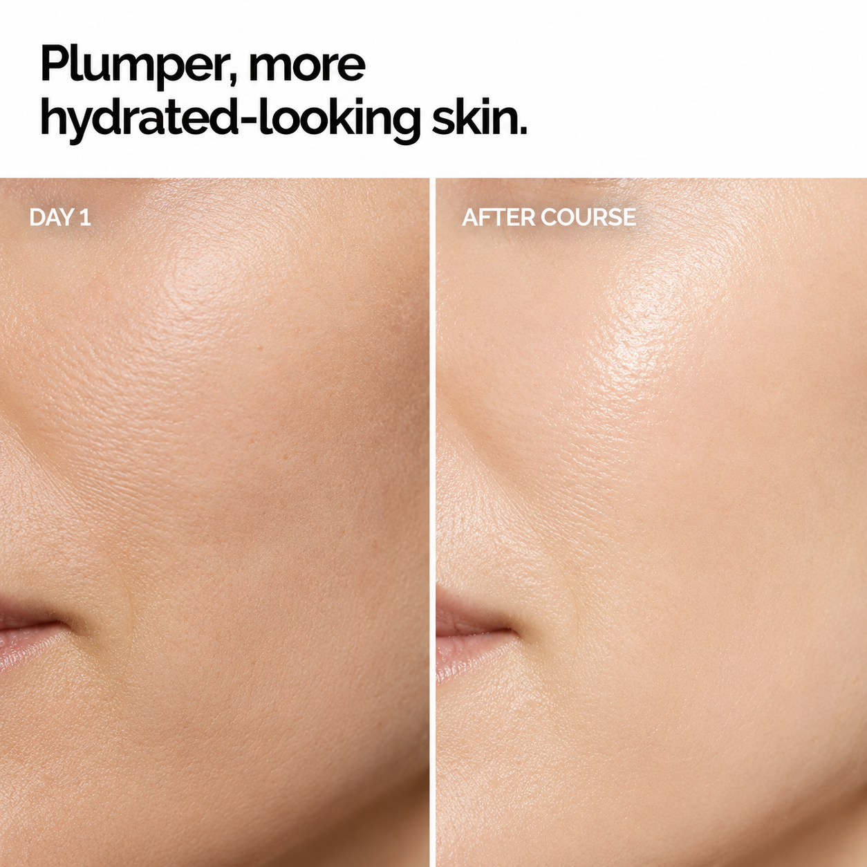 Hyaluronic Acid Ampoules - Ampoule