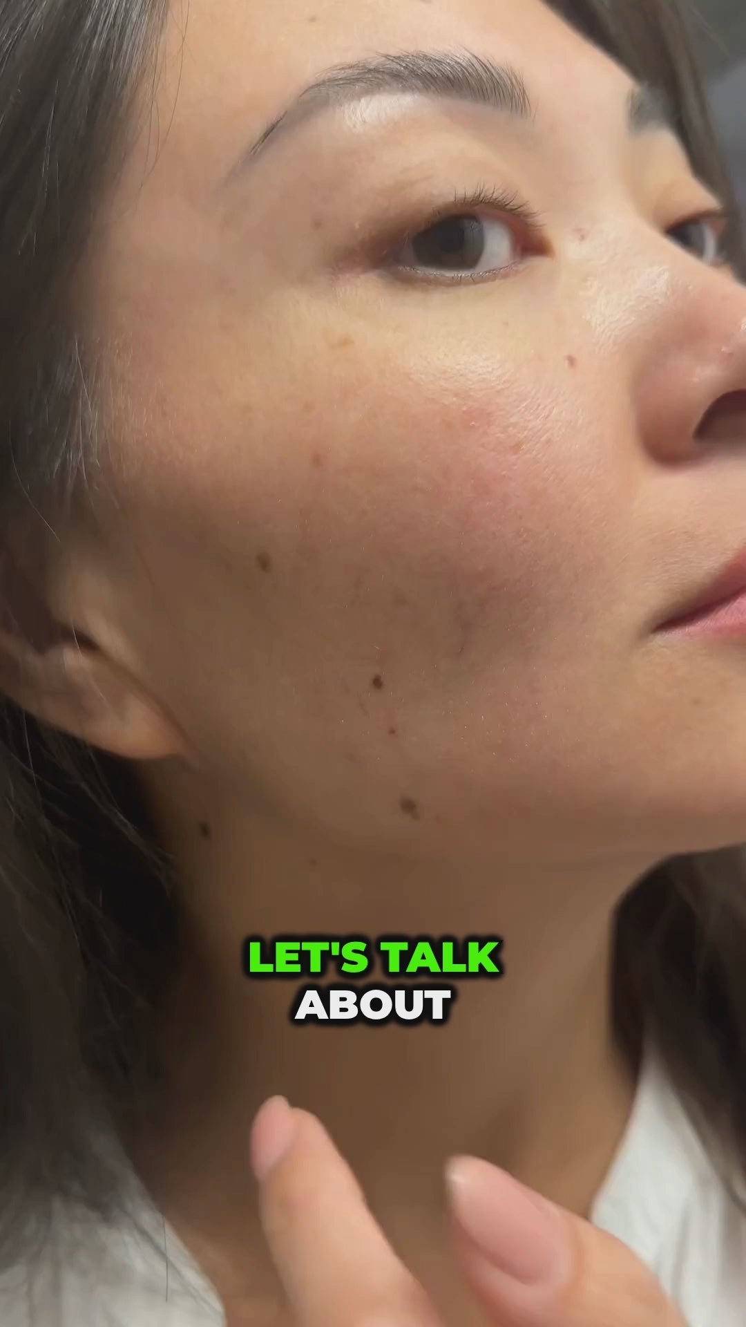 Load video: 40% AHA &amp; 4.5% Kojic Acid Peel