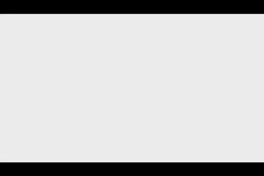 Load video: 40% AHA &amp; 4.5% Kojic Acid Peel