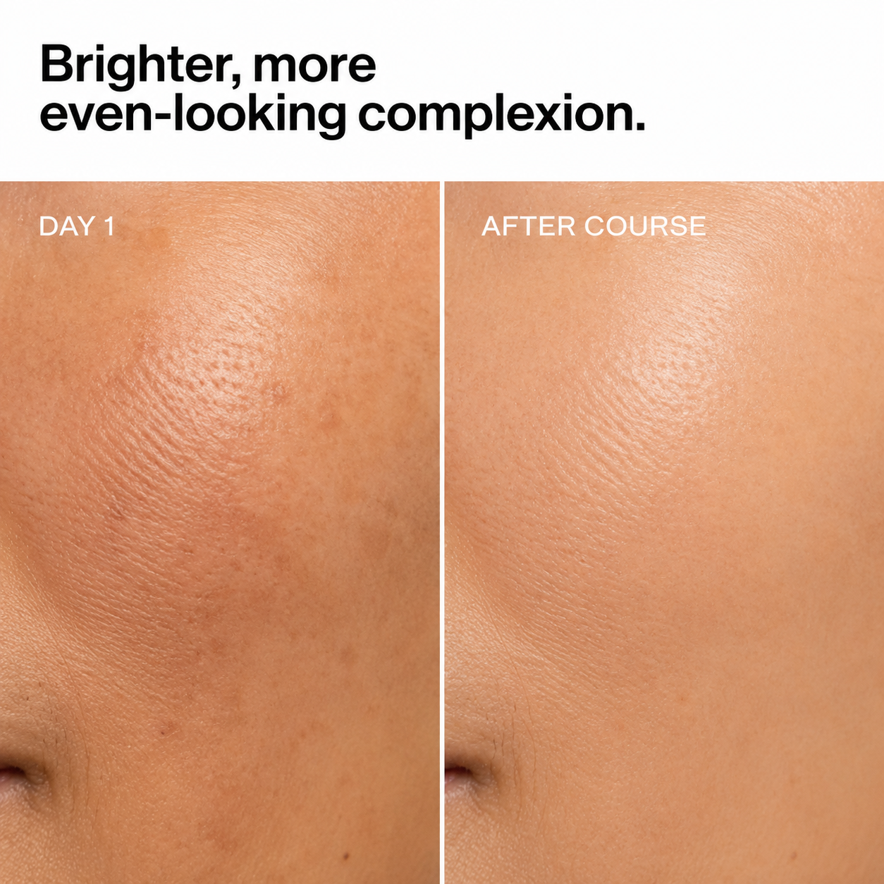 Kojic Acid Ampoules - Ampoule